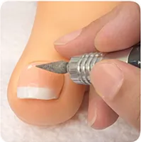 爪の表面を整える施術